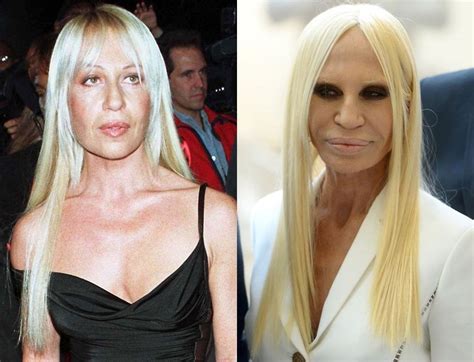 donatella versace plastic surgery|Donatella Versace Before and After Plastic Surgery.